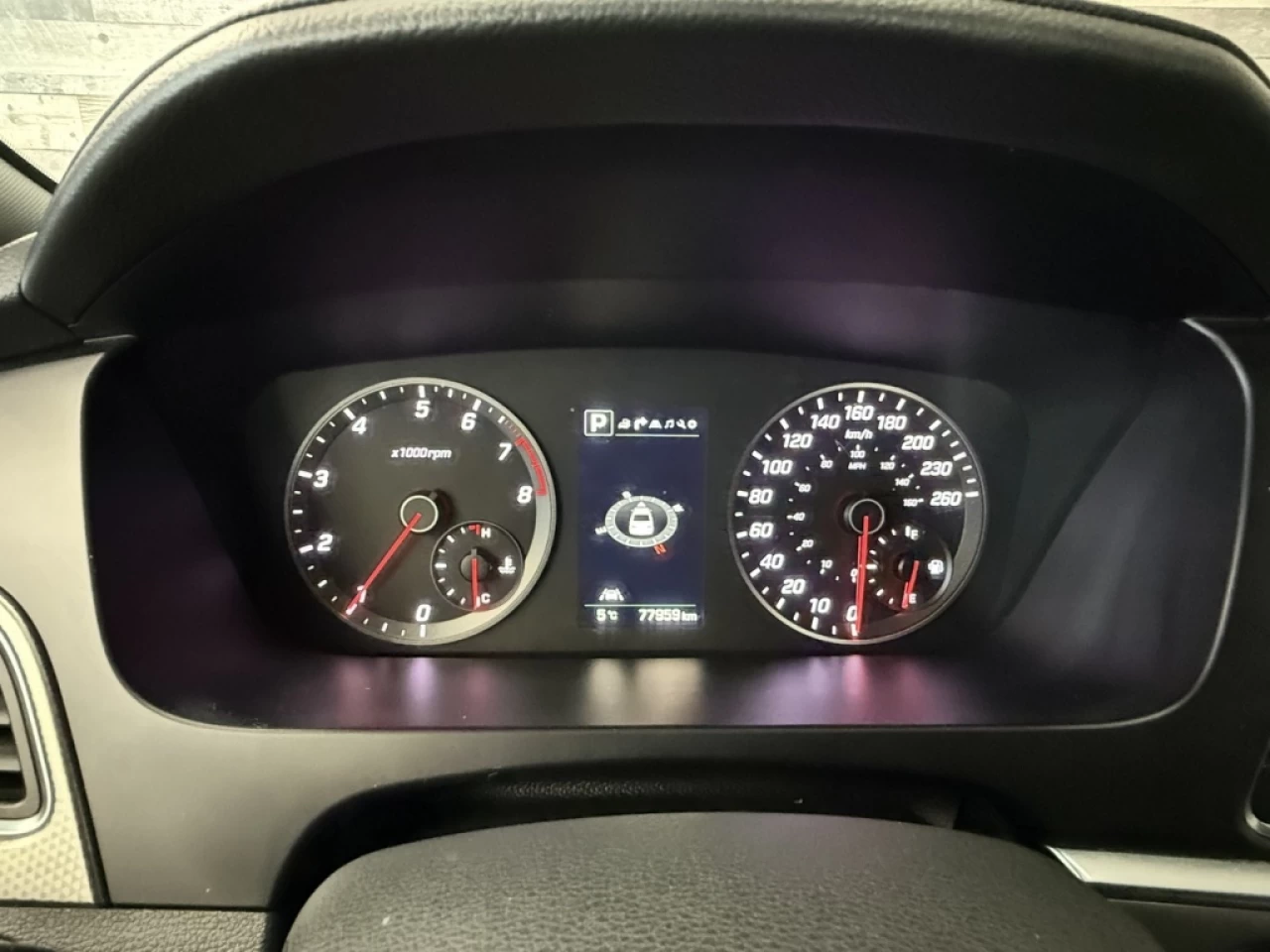 2016 Hyundai Sonata 2.0T Sport Ultimate CUIR NAV TOIT **APPROUVÉ À 99. Image principale